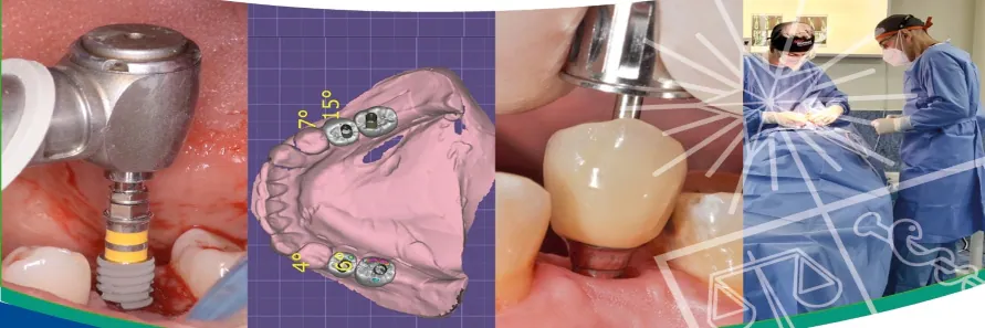 Especialidad en Implantología Buco Máxilo Facial