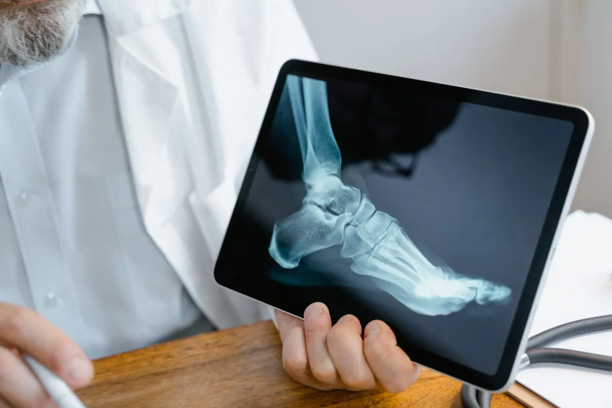 Estadía de Perfeccionamiento (Fellowship) en Radiología Músculo-Esquelética