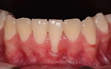 Programa de Especialización en Periodoncia | Uandes